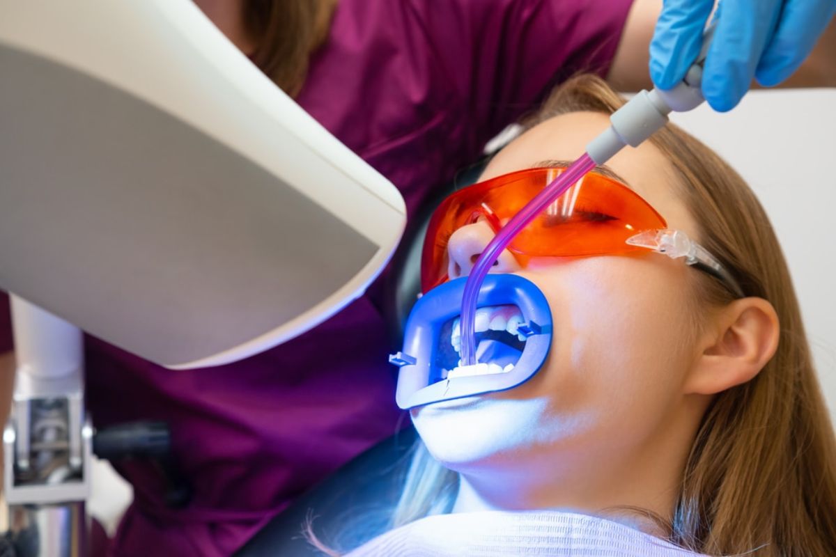 teeth whitening Charleston