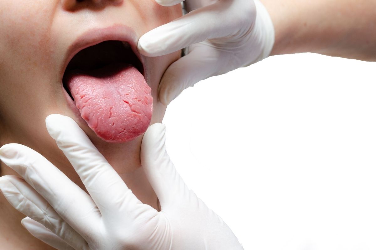 How long do tongue bumps take to heal