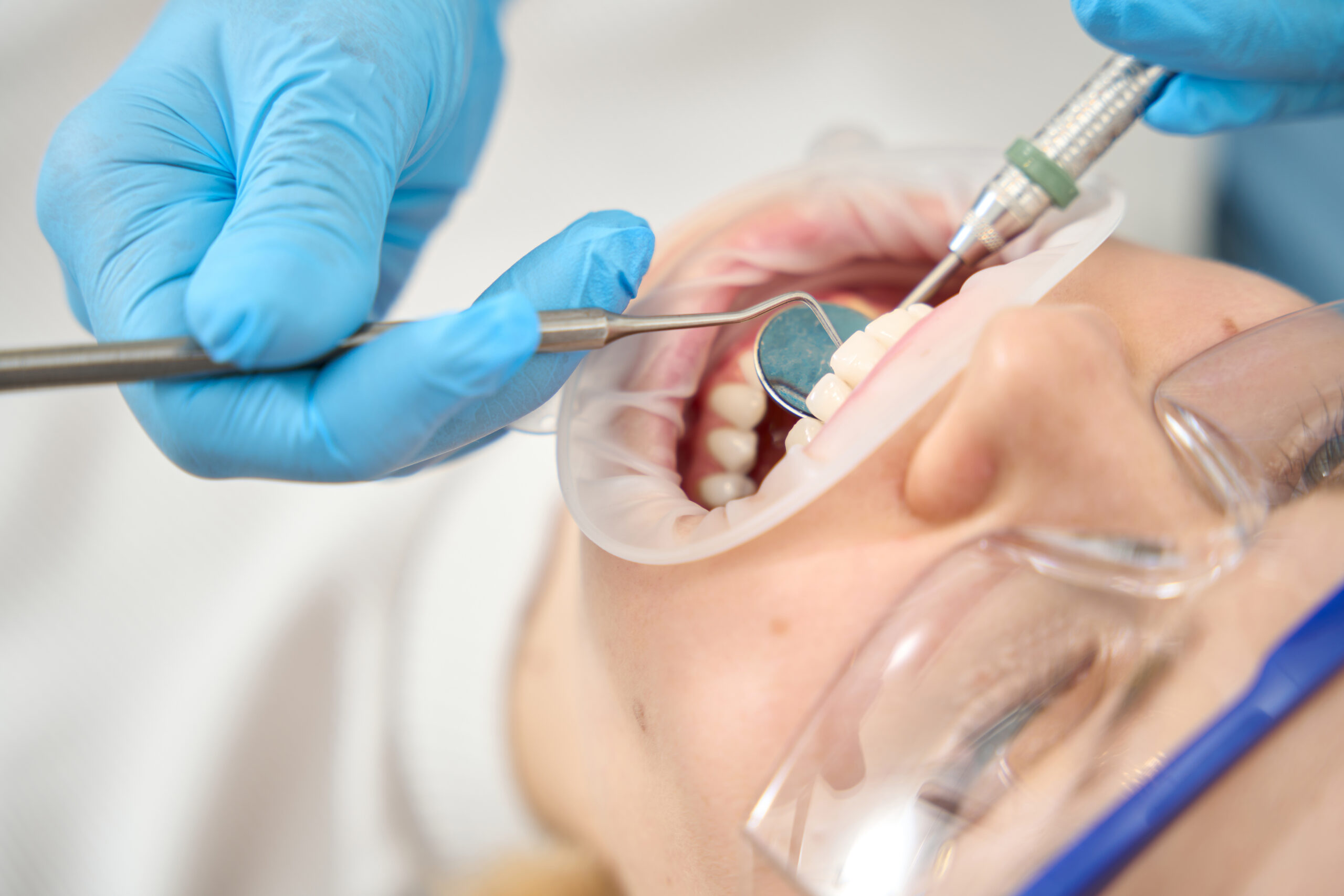 Dentist performing oral surgery while carefully examining a patient’s tooth during treatment