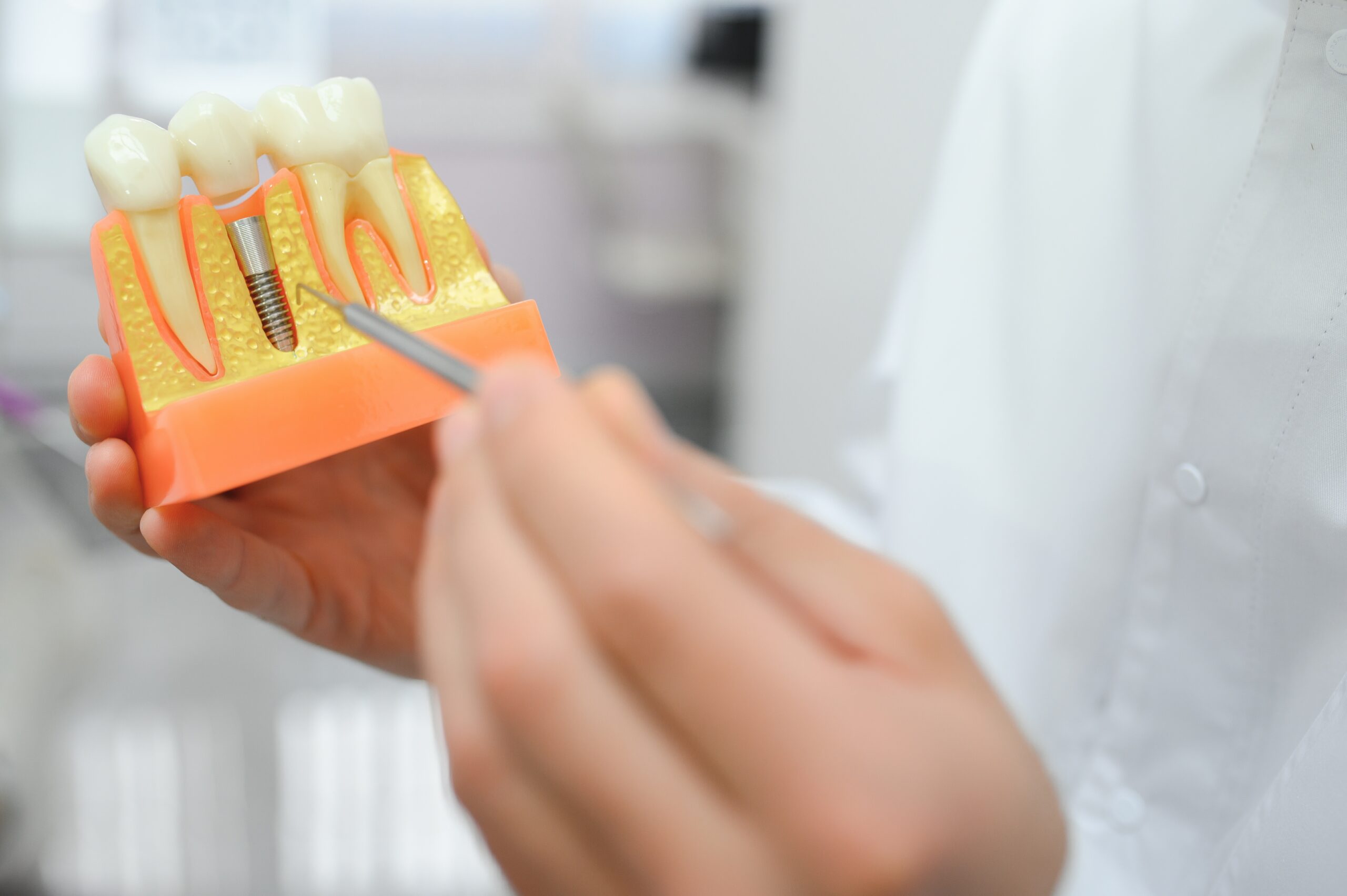 Dentist demonstrating a dental implant on a tooth model to explain structure and placement